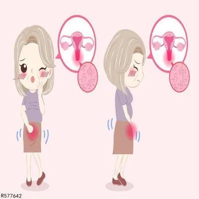 如何让子宫脱垂恢复正常