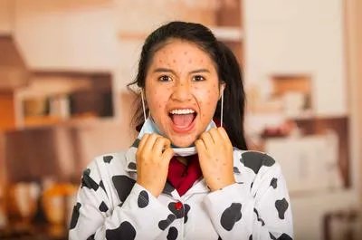 激光祛斑副作用有哪些 激光祛斑的常见副作用