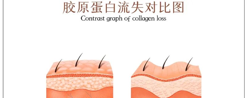 吃胶原蛋白有助于美容吗