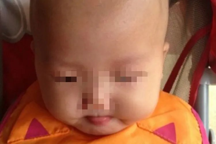 宝宝头两侧骨头突出图