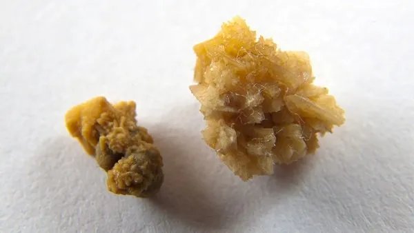 砭石怎么保养？砭石如何保养