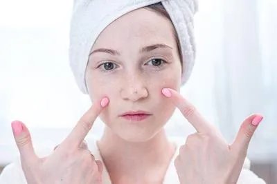 女性有斑点是什么原因引起 揭秘长斑的3原因