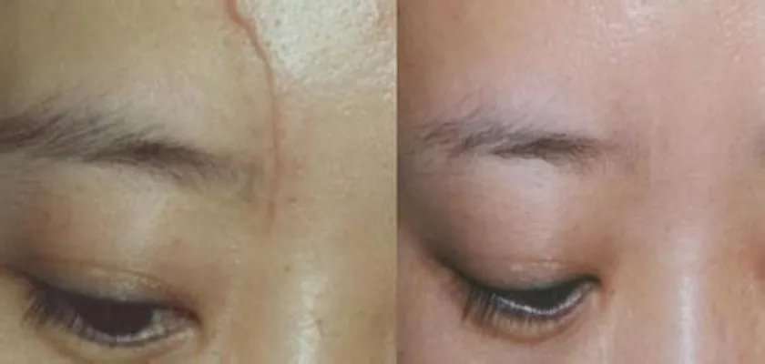 上海时光整形外科医院水氧活肤怎么样?全新价目介绍