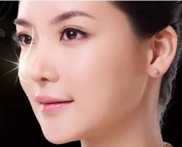 驼峰鼻治疗多少钱