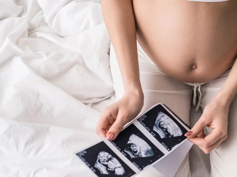 24周胎儿四维彩超检测范围