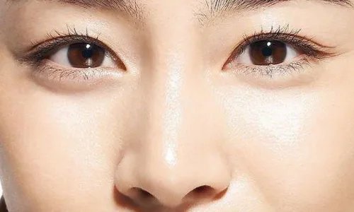 哪家割双眼皮好点