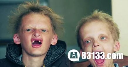 重庆惊现八岁僵尸娃 揭秘现代僵尸定义