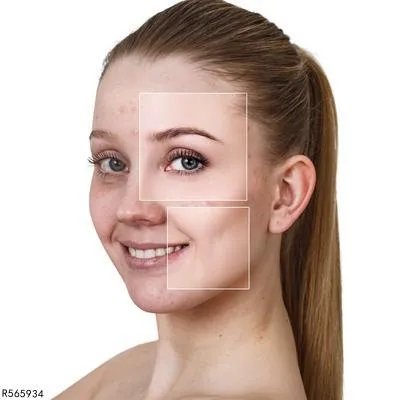 祛斑的最好方法是什么