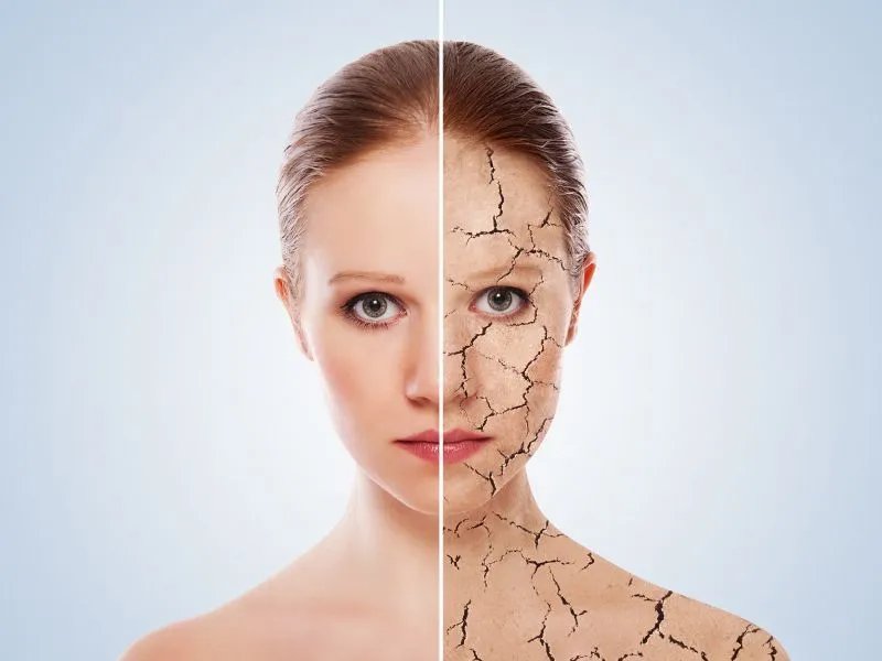 腿部皮肤粗糙怎么办