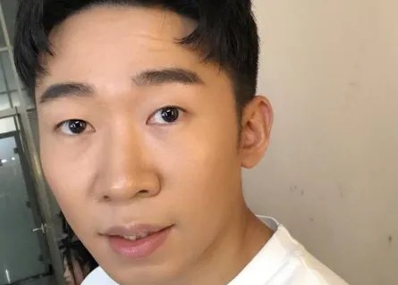 杨迪眼睛睑板腺消失了，这种现象年轻人身上普遍吗？