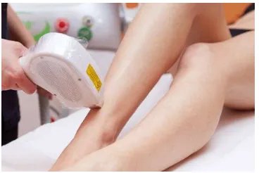 做光子脱毛哪里好