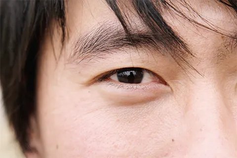 什么眼霜去眼袋效果好