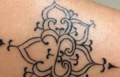 北京激光洗纹身价格一览表