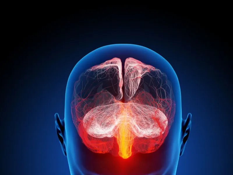 什么是格林巴利综合症