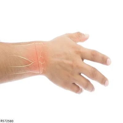 桡骨下端骨折的临床表现有哪些 揭秘桡骨下端骨折的3个表现