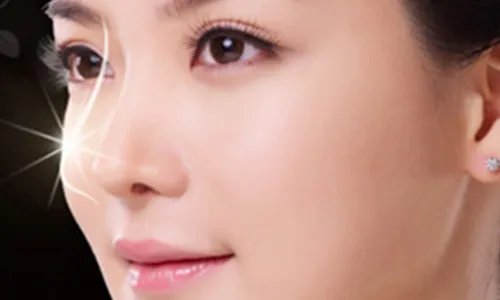 哪家割双眼皮好点