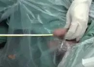 别往菊花和丁丁里塞奇怪的东西了,取出来的时候很疼的!