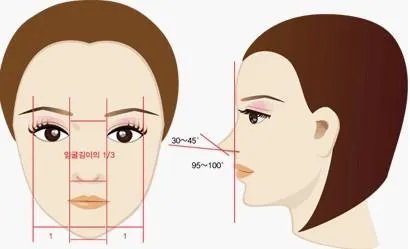 大鼻子如何整形