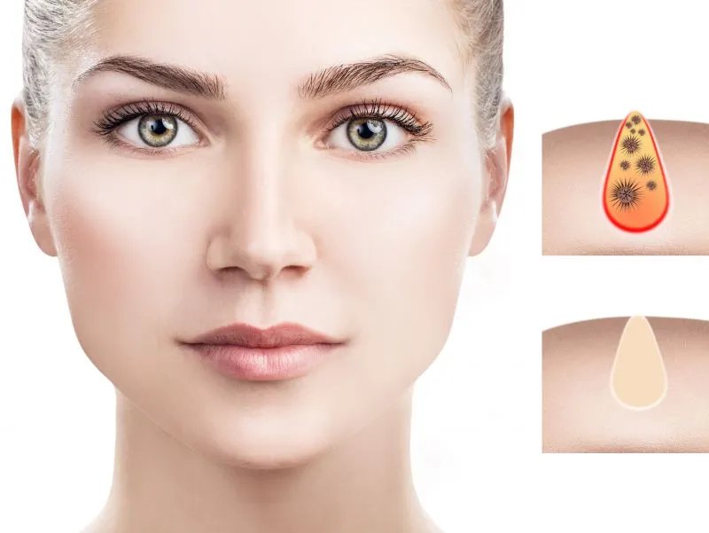 紧致毛孔的成分有哪些