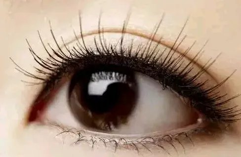 肿眼泡抽脂价格是多少