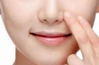 自体脂肪面部填充术的优点