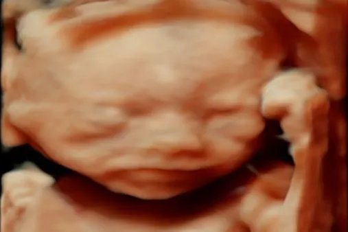 胎儿的四维彩超图片