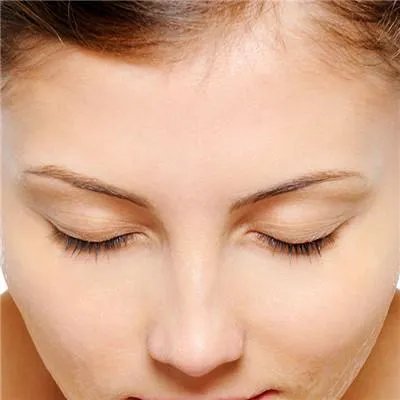 手术拉皮除皱的好处