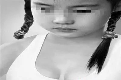 儿童性早熟症状图片