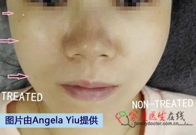 带你到香港寻找微整形新概念