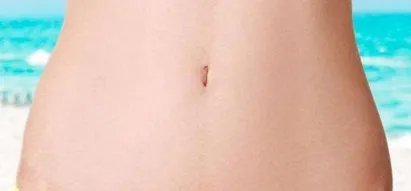 腰腹部抽脂怎样