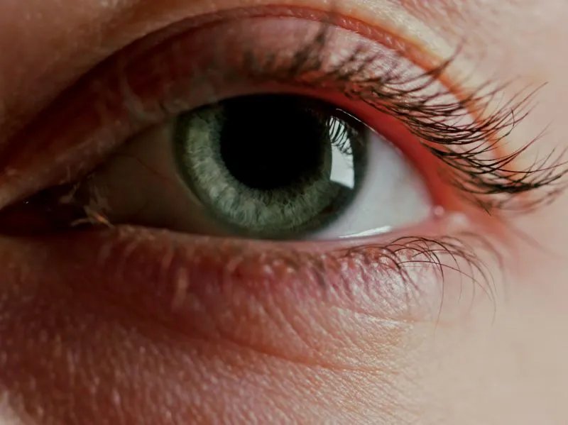 开内眼角哪里好