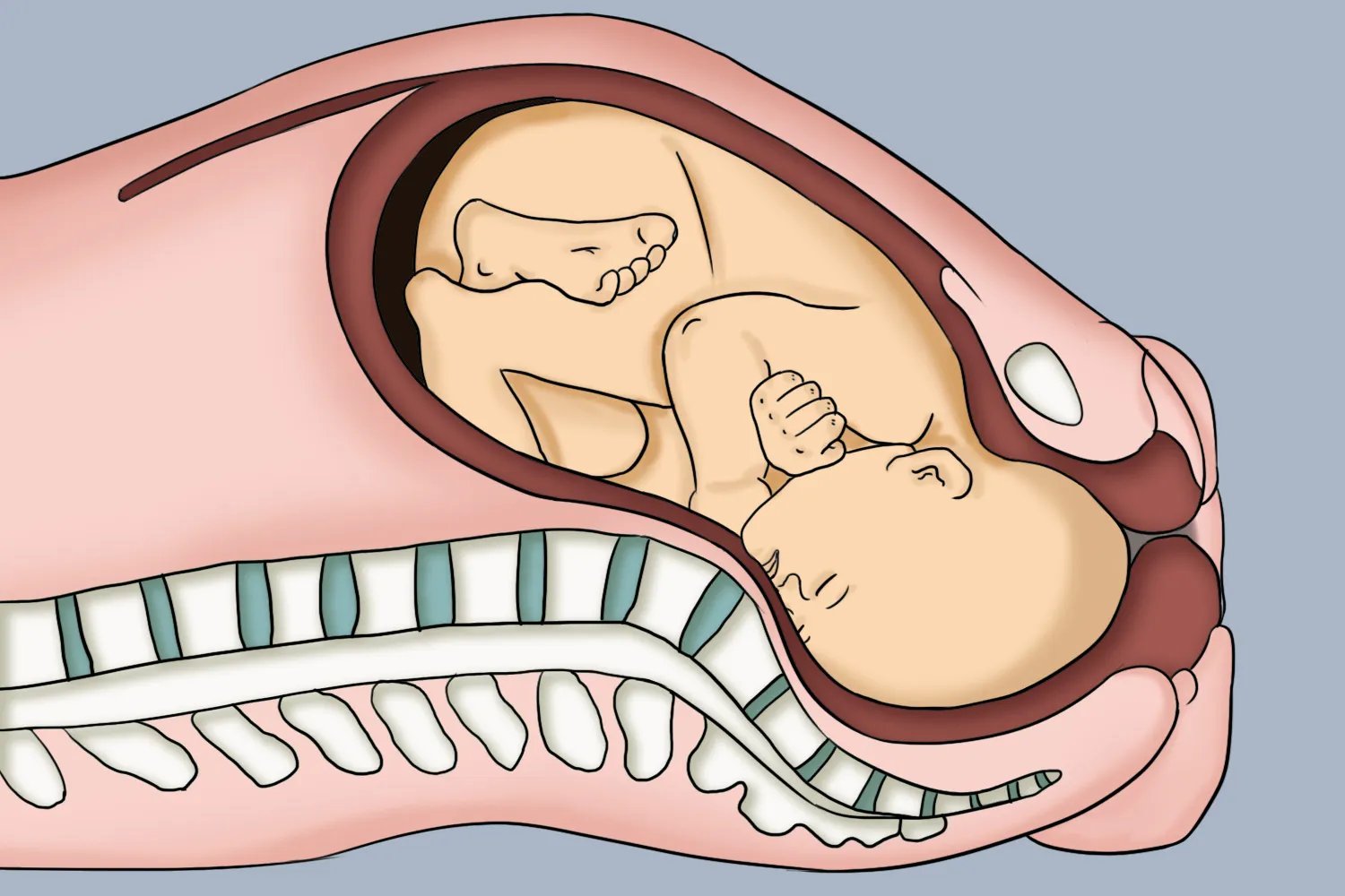 全入盆和半入盆图片