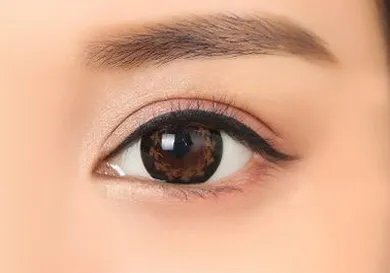 北京去眼袋的效果好么