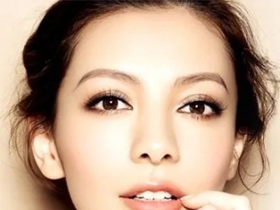 上海仁爱医院全切双眼皮怎么样?价格一般多少