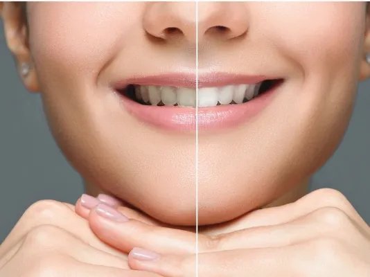 女性皮肤该怎么保养