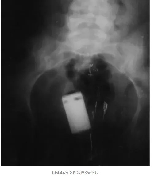 别往菊花和丁丁里塞奇怪的东西了,取出来的时候很疼的!