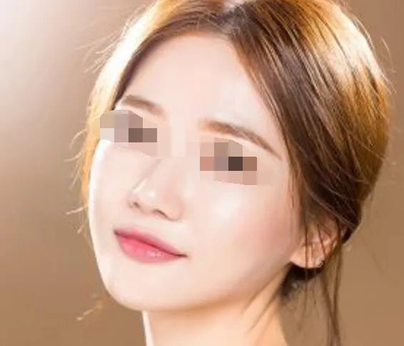 彩光嫩肤多少钱呢