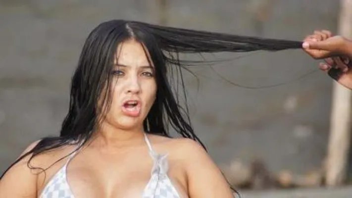 严重的神经性皮炎如何治疗呢