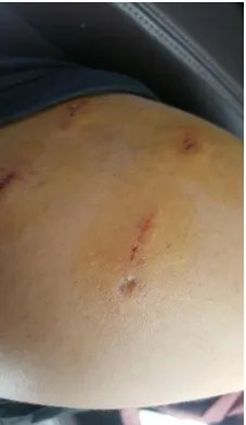 八达岭动物园黑熊咬伤游客被责令要求整改了吗？