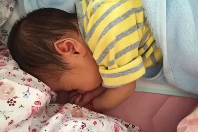 小儿黄疸的症状是什么