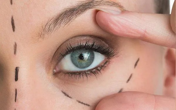 纹眉三天了还没结痂