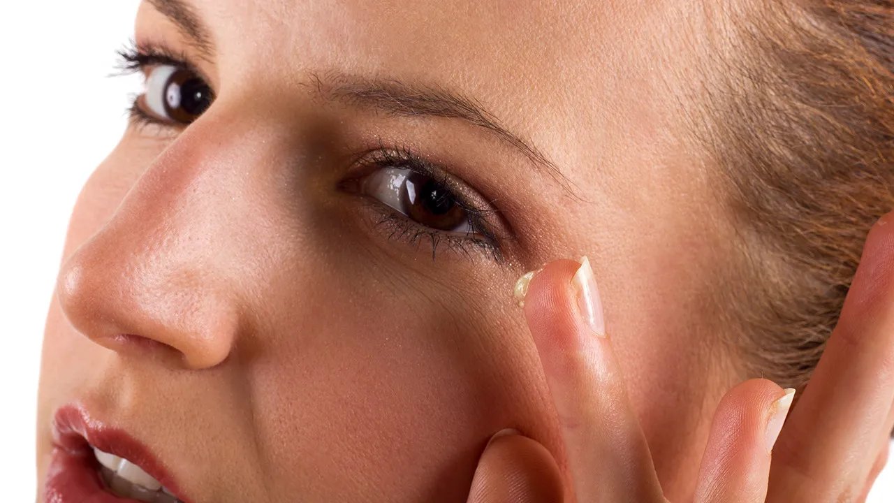 有鱼尾纹怎么办