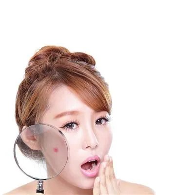 有哪些祛痘印医院