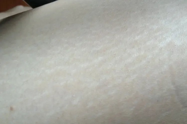 肥胖大肚子图片