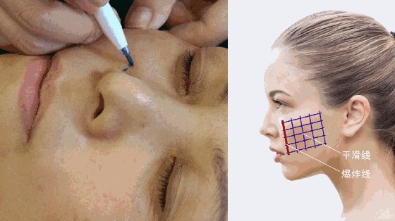 范冰冰到底做过整容吗？