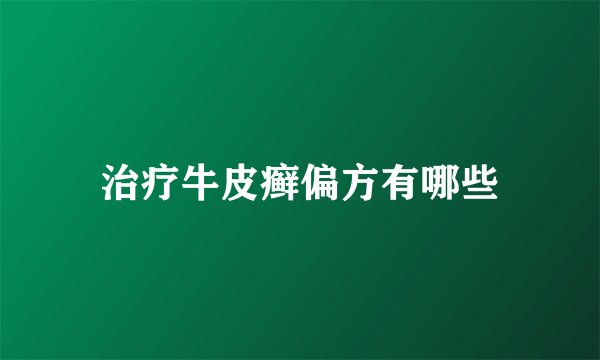 治疗牛皮癣偏方有哪些