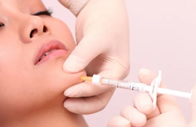 玻尿酸垫下巴的价格