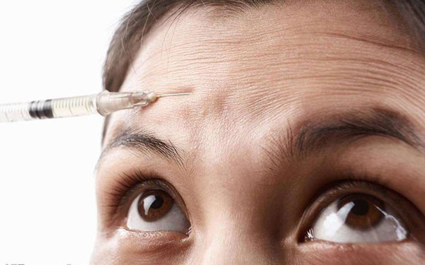 额头有抬头纹怎么去