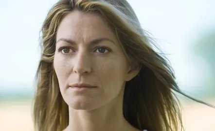 自体脂肪填充鼻唇沟效果