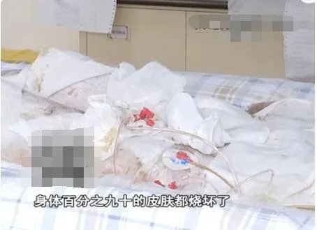 少女洗澡煤气爆炸现在什么情况?